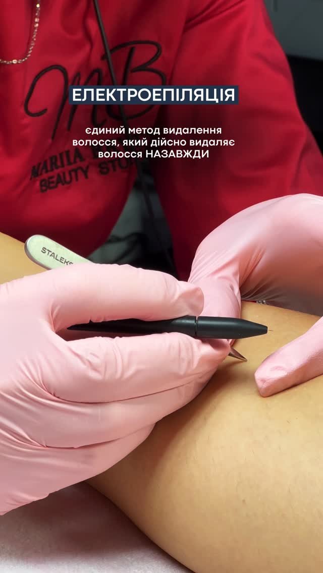 Elektrisch Ontharen Beauty Studio MB